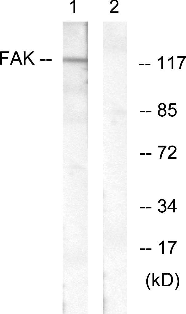 FAK / Focal Adhesion Kinase Antibody (p407)