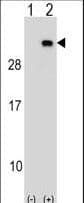 Polyclonal Rabbit anti-Human PGRMC2 Antibody (aa192-221, WB)