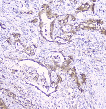 Polyclonal Rabbit anti-Human CDA / Cytidine Deaminase Antibody (IHC, WB)