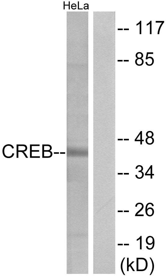 Polyclonal Rabbit anti-Human CREB1 / CREB Antibody (p129, IHC, WB)