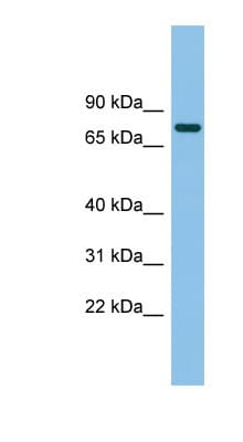 Polyclonal Rabbit anti-Human MTMR14 Antibody (aa395-444, WB)