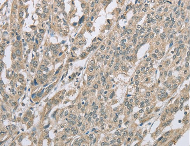 Polyclonal Rabbit anti-Human EDA2R / XEDAR Antibody (IHC, WB)