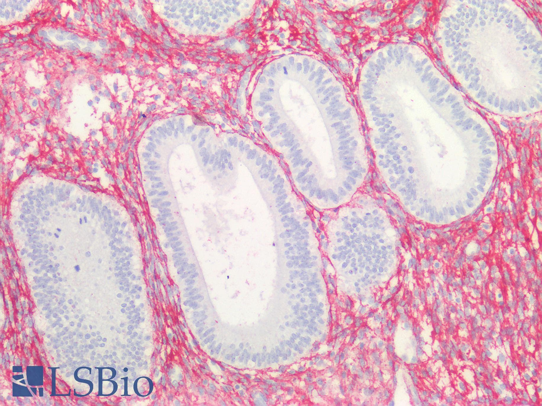PathPlus™ COL3A1 / Collagen III Antibody