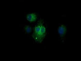 KLK8 / Kallikrein 8 Antibody (clone OTI3C10)
