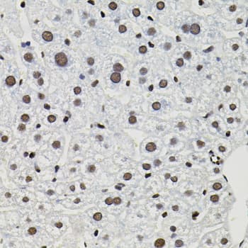 GTF2I / TFII I Antibody