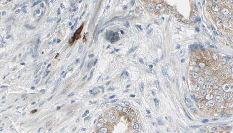 CCT3 Antibody