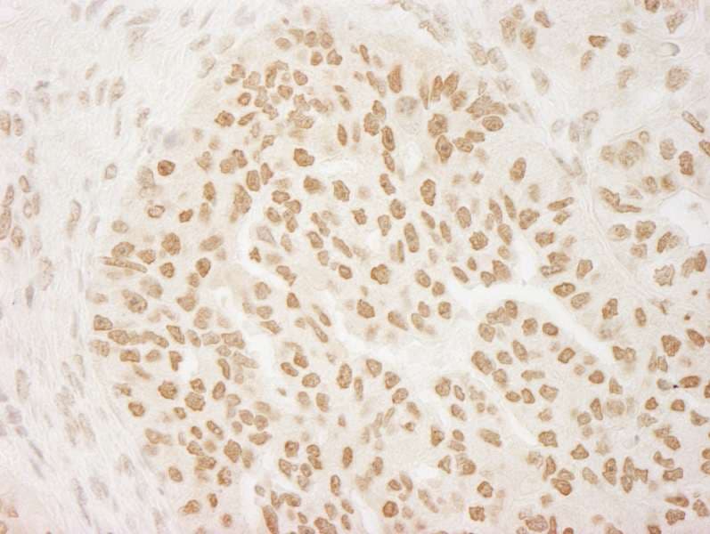PRMT6 Antibody (aa325-C-term)