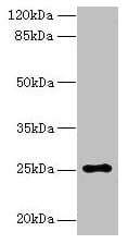 Polyclonal Rabbit anti-Human ARPIN / C15orf38 Antibody (IHC, WB)