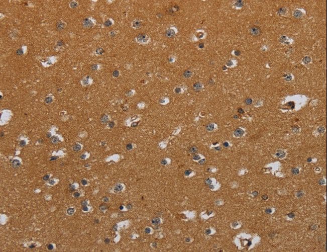 Polyclonal Rabbit anti-Human CSH1 / Placental Lactogen Antibody (IHC, WB)