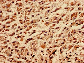 Polyclonal Rabbit anti-Human RPLP0 Antibody (aa1-317)