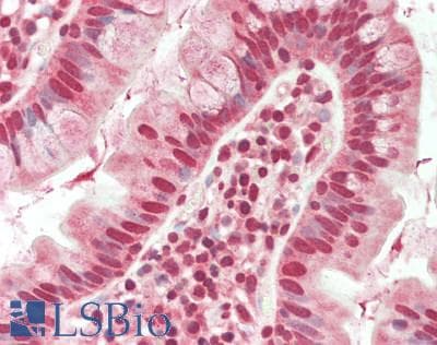 IHC-plus™ Polyclonal Rabbit anti-Human FLCN / Folliculin Antibody (aa1-50, IHC, WB)