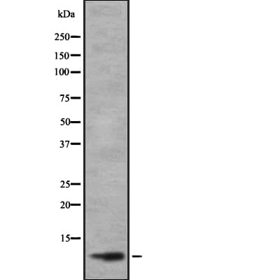 BHLHA19 / TAL2 Antibody