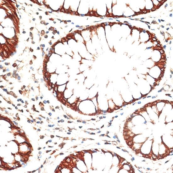 KRT13 / CK13 / Cytokeratin 13 Antibody