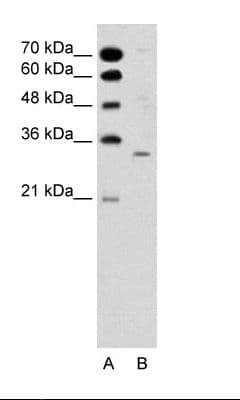 ATF5 Antibody (aa101-150)