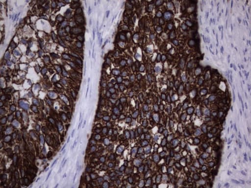 Monoclonal Rat anti-Human Acidic Cytokeratin Antibody (clone 9H3, IHC)