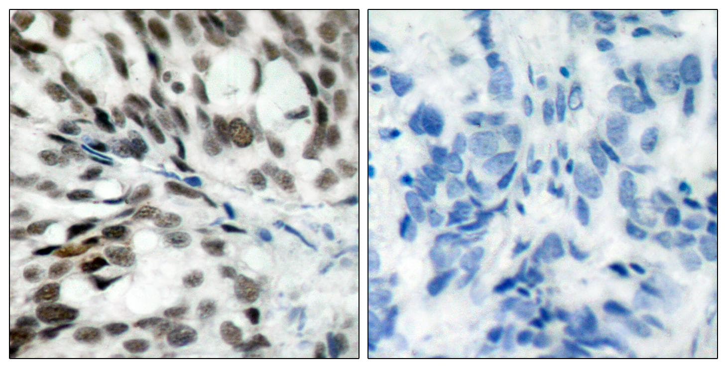 RB1 / Retinoblastoma / RB Antibody (p780)