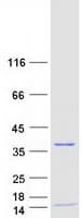 Human RPA4 Protein (Recombinant Myc-DDK (Flag))