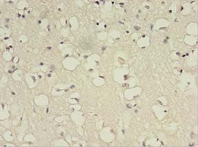 Polyclonal Rabbit anti-Human BDNF Antibody (IHC)