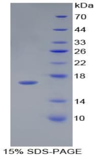 Human DHH / Desert Hedgehog Protein (Recombinant His)
