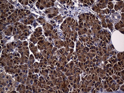 ALDH7A1 Antibody (clone OTI1A9, Carrier-free)