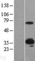 SUSD4 Protein (Over-Expression Lysate Myc-DDK (Flag))