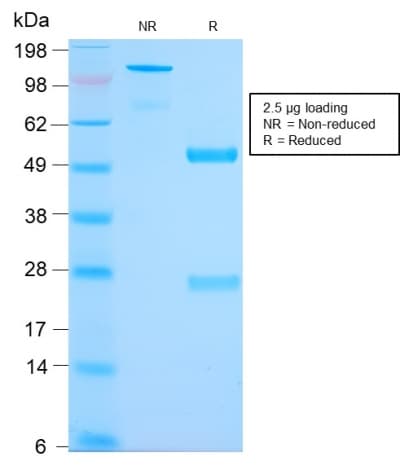 PathPlus™ Mucin 2 / MUC2 Antibody (clone MLP/2970R)
