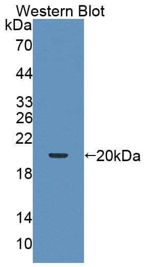 TRIM3 Antibody (aa2-152, FITC)