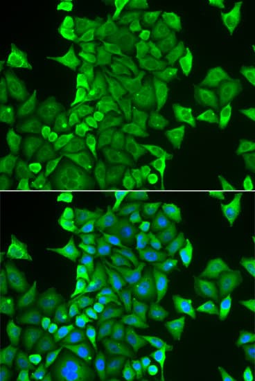 IHC-plus™ CARS1 / CARS Antibody