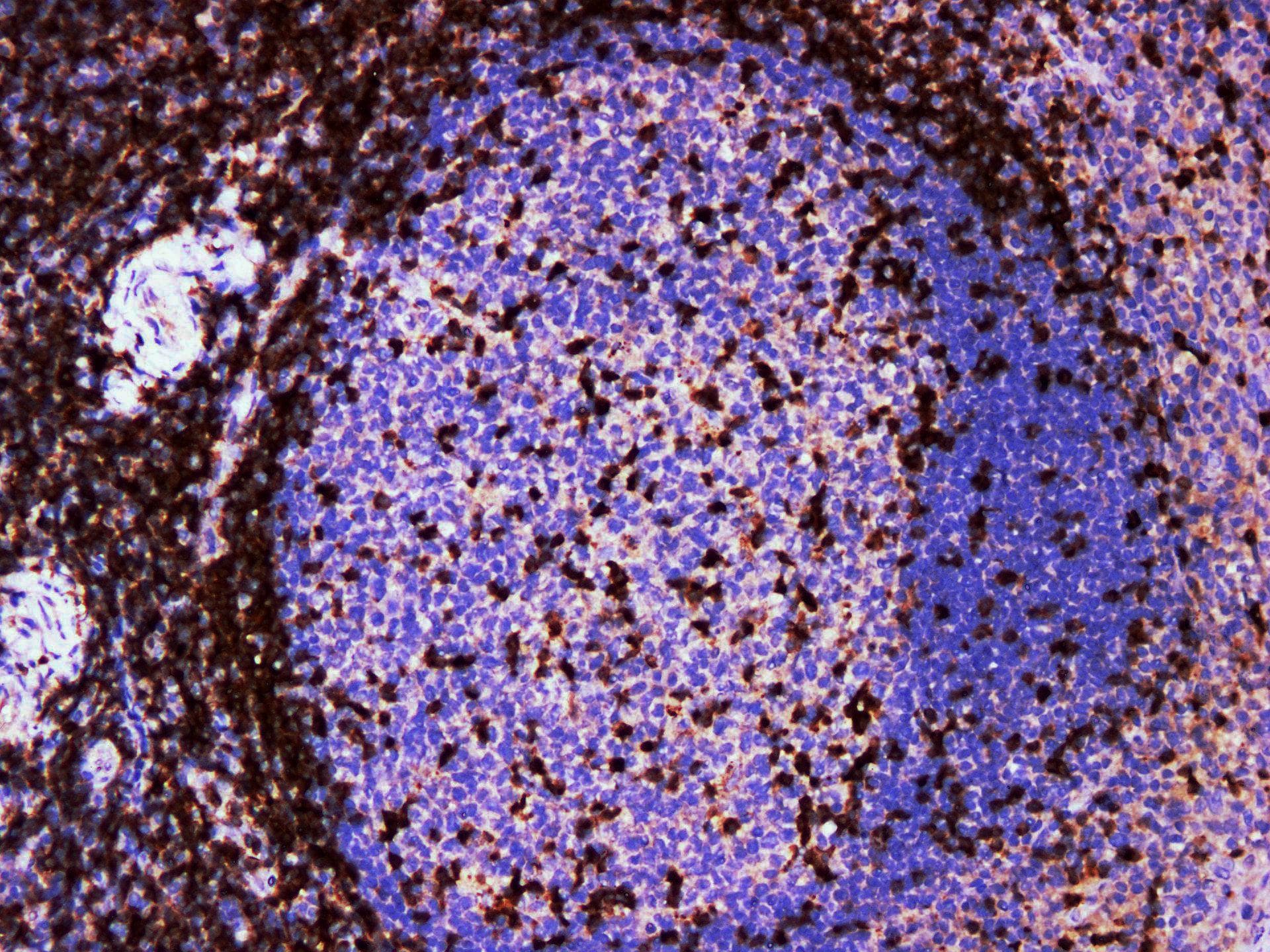 ZAP70 Antibody