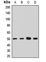 Polyclonal Rabbit anti-Human SLC9A3R1 / NHERF1 / EBP50 Antibody (WB)