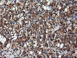 PSMA6 Antibody (clone OTI7C2)