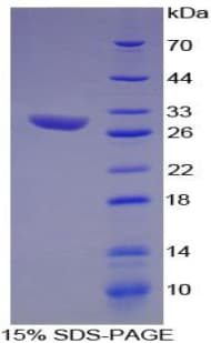 Rat HAO1 Protein (Recombinant His)