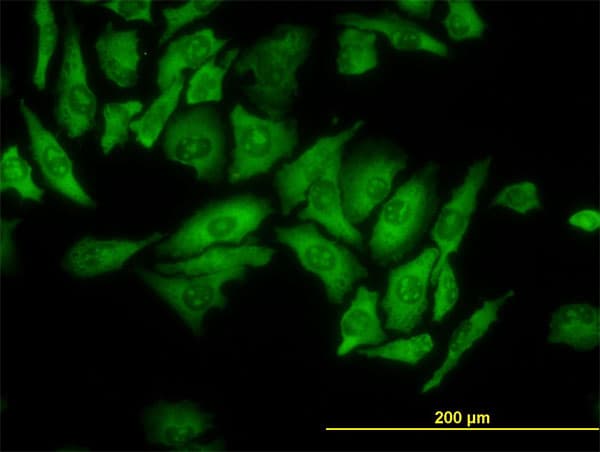 IHC-plus™ RPL4 / Ribosomal Protein L4 Antibody (clone 4A3)