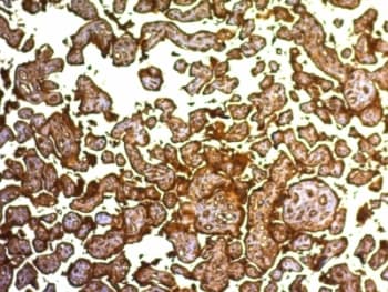 PLAP / Alkaline Phosphatase Antibody (clone SPM593, Azide-free, BSA-free)