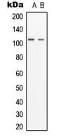 GCP3 / TUBGCP3 Antibody (aa216-255)