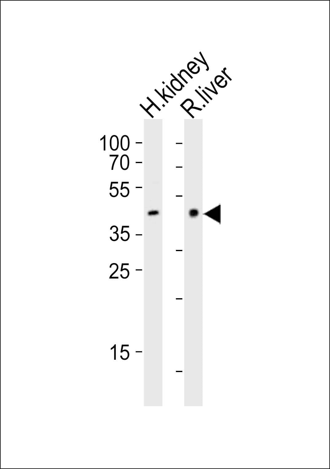 IHH Antibody (aa397-430)