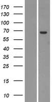 UGT2A1 Protein (Over-Expression Lysate Myc-DDK (Flag))