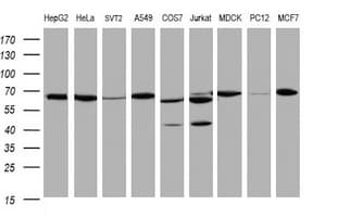HSPD1 / HSP60 Antibody (clone OTI3G1)