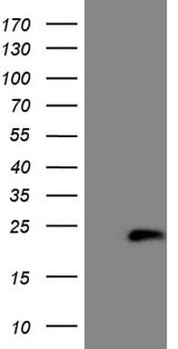 HPCAL4 Antibody (aa2-191, clone OTI3C3)