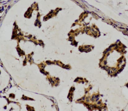 LIPE / HSL Antibody (Pro548)