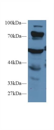 PCCA Antibody (HRP)