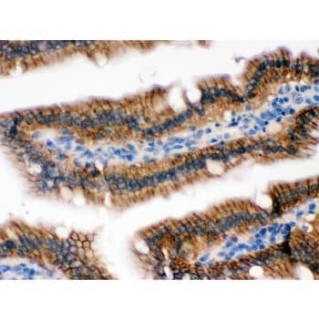 Polyclonal Rabbit anti-Human RENT1 / UPF1 Antibody (aa578-614, IHC, WB)