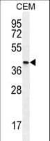 IHC-plus™ Polyclonal Rabbit anti-Human Osteoglycin / Mimecan Antibody (aa246-276, IHC, WB)