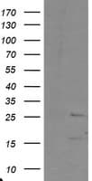 PYCARD / ASC / TMS1 Antibody (clone OTI1H6)