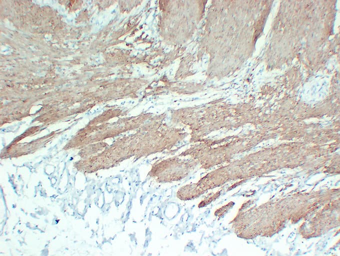 CNN1 / Calponin Antibody (clone ABT-CALP)