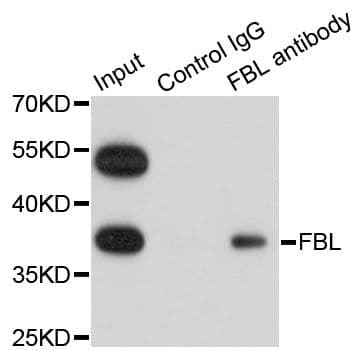 FBL / FIB / Fibrillarin Antibody