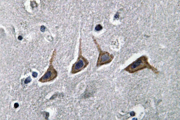 SLC22A6 / OAT1 Antibody (Leu304)