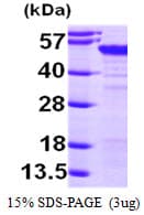Human MAGEA4 Protein (Recombinant 6His, N-terminus)