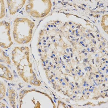 IHC-plus™ PCCB Antibody (aa289-539)
