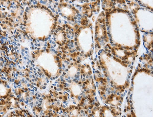 Polyclonal Rabbit anti-Human SELS Antibody (IHC)